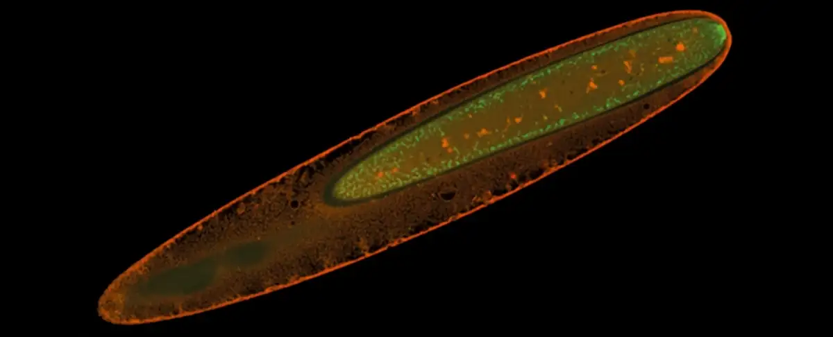 Atencion! Cientificos Desvelan Secretos De Bacteria Gigante