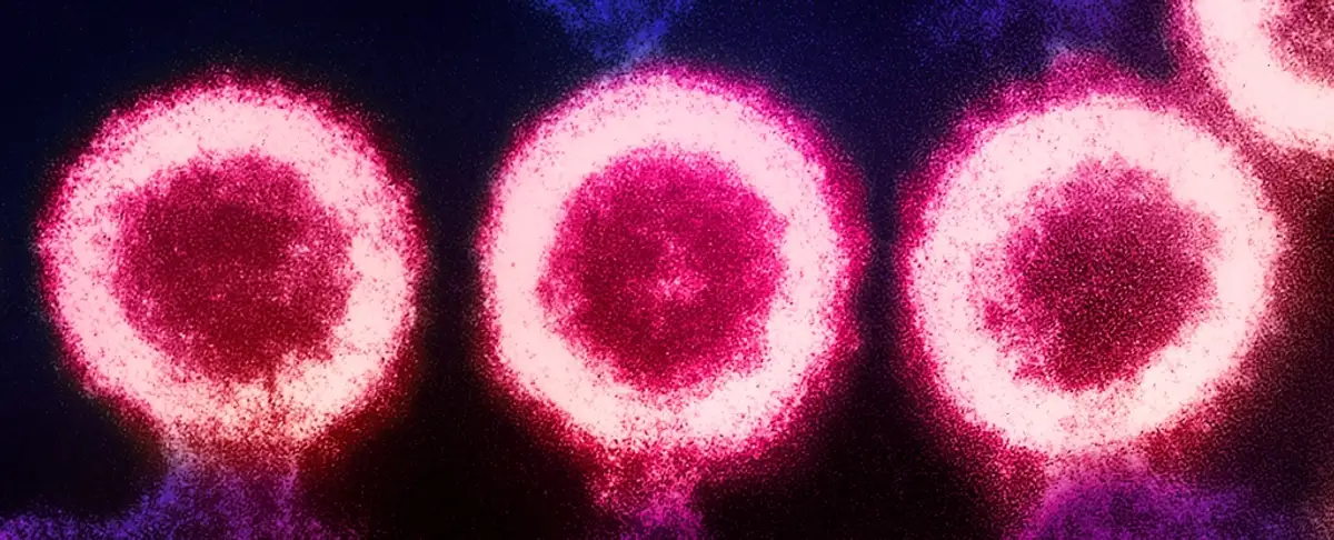 Los Antiguos Virus Determinaron El Tamano De Nuestros Cerebros