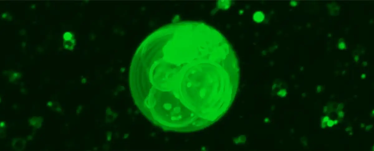 El Origen De La Vida Cientificos Cerca De Desvelar El Misterio!